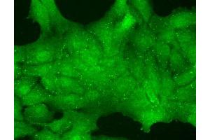 Immunofluorescence (fixed cells) (IF/ICC) image for anti-Transient Receptor Potential Cation Channel, Subfamily C, Member 7 (TRPC7) (AA 845-862) antibody (FITC) (ABIN2485430)