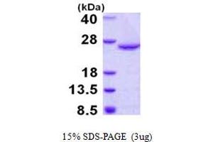 SDS-PAGE (SDS) image for Dual Specificity Phosphatase 18 (DUSP18) (AA 1-188) protein (His tag) (ABIN668030)