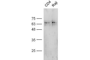 Mouse stomach probed with Anti-CD4 Polyclonal Antibody, Unconjugated  at 1:5000 for 90 min at 37˚C. (CD4 Antikörper  (AA 301-400))