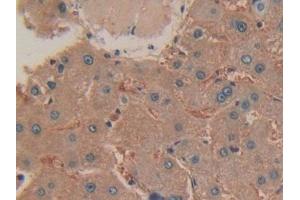 Immunohistochemistry (IHC) image for anti-Mechanistic Target of Rapamycin (serine/threonine Kinase) (mTOR) (AA 2226-2488) antibody (ABIN7440680)