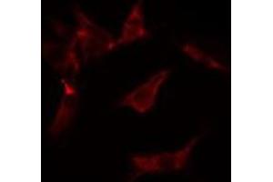 ABIN6275591 staining  Hela cells by IF/ICC. (ATP1A2 Antikörper  (N-Term))