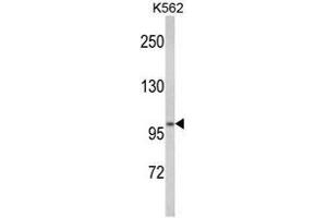 Western blot analysis of ATP12A Antibody (Center) in K562 cell line lysates (35ug/lane). (ATP12A Antikörper  (Middle Region))