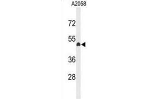 Western Blotting (WB) image for anti-Eyes Absent Homolog 4 (EYA4) antibody (ABIN3004136) (EYA4 Antikörper)