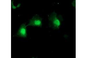 Anti-MPI mouse monoclonal antibody (ABIN2455793) immunofluorescent staining of COS7 cells transiently transfected by pCMV6-ENTRY MPI (RC208134). (MPI Antikörper)