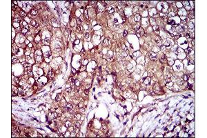 Immunohistochemistry (IHC) image for anti-Interleukin 3 Receptor, alpha (IL3RA) (AA 200-305) antibody (ABIN1845738) (IL3RA Antikörper  (AA 200-305))