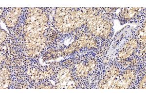 Immunohistochemistry (IHC) image for anti-Thioredoxin Interacting Protein (TXNIP) (AA 32-367) antibody (ABIN7433198)