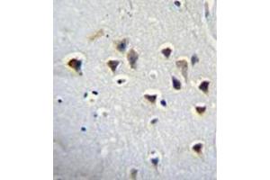 Immunohistochemistry analysis in formalin fixed and paraffin embedded human brain tissue reacted with NMDA Receptor 2A Antibody (Center) followed by peroxidase conjugation of the secondary antibody and DAB staining.