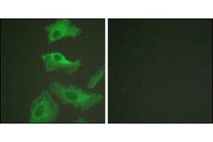 Immunofluorescence analysis of HeLa cells, treated with TNF-a (20nM, 15 mins), using HSP90B (Ab-254) antibody. (HSP90AB1 Antikörper)