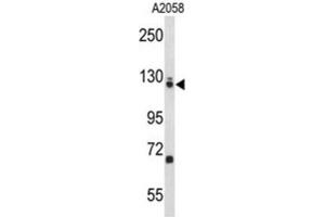 Western Blotting (WB) image for anti-Elongation Factor Tu GTP Binding Domain Containing 2 (EFTUD2) antibody (ABIN3004116) (EFTUD2 Antikörper)