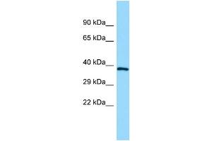 WB Suggested Anti-GPR160 Antibody Titration: 1. (GPR160 Antikörper  (C-Term))