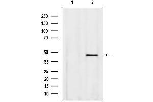 anti-Bardet-Biedl Syndrome 5 (BBS5) (C-Term) antibody