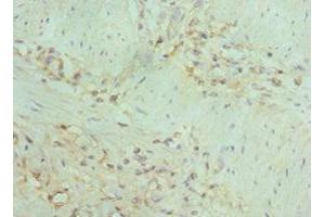 Immunohistochemistry of paraffin-embedded human gallbladder tissue using ABIN7150715 at dilution of 1:100 (MAP2K5 Antikörper  (AA 1-190))