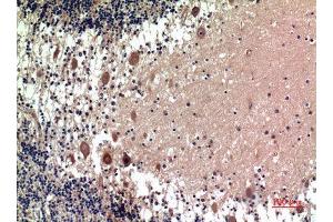 Immunohistochemistry (IHC) analysis of paraffin-embedded Human Brain, antibody was diluted at 1:100. (5HT1D Antikörper)