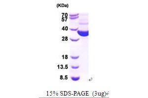 Figure annotation denotes ug of protein loaded and % gel used. (Thioredoxin Reductase Protein (TrxR) (AA 1-321))