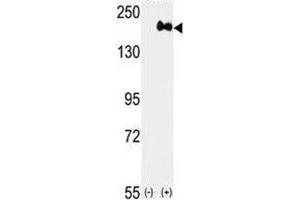 Western blot analysis of anti-HER2 antibody and 293 cell lysate (2 ug/lane) either nontransfected (Lane 1) or transiently transfected with the ERBB2 gene (2). (ErbB2/Her2 Antikörper  (AA 1227-1255))