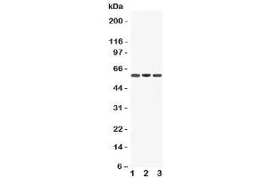 Western blot testing of Dopamine Receptor D5 antibody and Lane 1:  rat brain (DRD5 Antikörper  (C-Term))