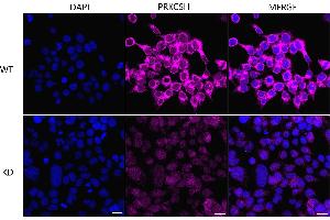 Immunocytochemical staining of HeLa cells using PRKCSH antibody (ABIN7799984), 1:1,000), Top panel: wild-type (WT), Bottom panal: PRKCSH shRNA knockdown (KD). (Rekombinanter PRKCSH Antikörper)