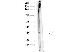 anti-CPX Chromosome Region, Candidate 1 (CPXCR1) (N-Term) antibody