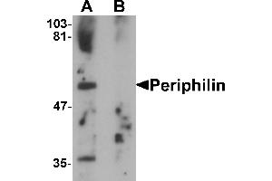 Western blot analysis of Periphilin in mouse colon tissue lysate with Periphilin antibody at 1 µg/mL in (A) the absence and (B) the presence of blocking peptide. (PPHLN1 Antikörper  (Middle Region))