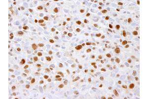 Immunohistochemistry (IHC) image for anti-Minichromosome Maintenance Complex Component 2 (MCM2) (pSer41) antibody (ABIN7448648) (MCM2 Antikörper  (pSer41))