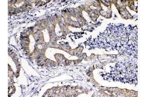 Immunohistochemistry (IHC) image for anti-Tumor Necrosis Factor (Ligand) Superfamily, Member 18 (TNFSF18) (AA 70-199) antibody (ABIN5519067)