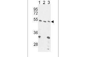 Western blot analysis of FOXP3 Antibody (C-term) (ABIN389295 and ABIN2839415) in 293(lane 1), Jurkat cell line(lane 2) and mouse liver tissue(lane 3) lysates (35 μg/lane). (FOXP3 Antikörper  (C-Term))
