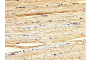 IHC image of ABIN7165118 diluted at 1:300 and staining in paraffin-embedded human skeletal muscle tissue performed on a Leica BondTM system. (BORA Antikörper  (AA 178-312))