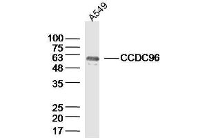 Lane 1: A549 lysates probed with CCDC96 Polyclonal Antibody, Unconjugated  at 1:300 overnight at 4˚C. (CCDC96 Antikörper  (AA 301-400))
