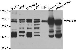 Western blot analysis of extracts of various cell lines, using PRODH antibody (ABIN5973448) at 1/1000 dilution. (PRODH Antikörper)