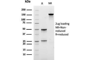 SDS-PAGE Analysis Purified LLC Recombinant Mouse Monoclonal Antibody (rLLC/3777). (Rekombinanter IgL Antikörper)