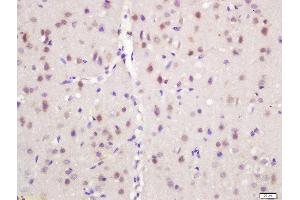 Formalin-fixed and paraffin embedded mouse brain labeled with Rabbit Anti-NARC1 Polyclonal Antibody, Unconjugated (ABIN761831) at 1:200 followed by conjugation to the secondary antibody and DAB staining (PCSK9 Antikörper  (AA 231-330))