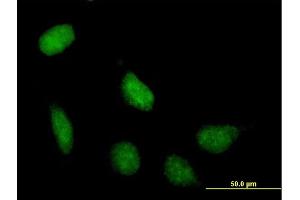 Immunofluorescence of purified MaxPab antibody to SIRT7 on HeLa cell. (SIRT7 Antikörper  (AA 1-400))