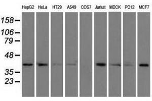 Image no. 7 for anti-Acetyl-CoA Acetyltransferase 2 (ACAT2) antibody (ABIN1496403) (ACAT2 Antikörper)