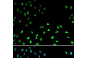 Immunofluorescence analysis of MCF-7 cells using RFC1 Polyclonal Antibody (RFC1 Antikörper)