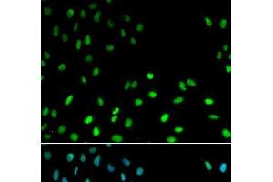 Immunofluorescence analysis of MCF-7 cells using RFC1 Polyclonal Antibody (RFC1 Antikörper)