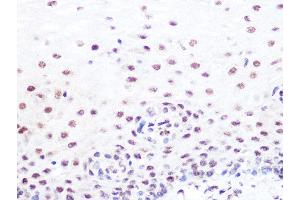 Immunohistochemistry of paraffin-embedded human esophageal using SUMO2/3 Rabbit mAb (ABIN7270370) at dilution of 1:100 (40x lens). (SUMO2 Antikörper)
