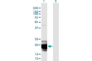 Western Blot analysis of IL23A expression in transfected 293T cell line by IL23A monoclonal antibody (M01), clone 4C8. (IL23A Antikörper  (AA 1-189))