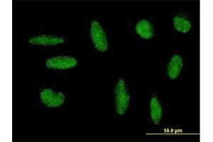 Immunofluorescence of purified MaxPab antibody to ZNF383 on HepG2 cell. (ZNF383 Antikörper  (AA 1-475))