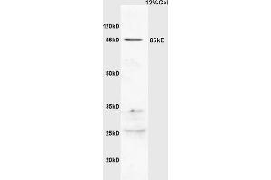 Human colon carcinoma lysates probed with Anti PI 3 Kinase p85 beta Polyclonal Antibody, Unconjugated (ABIN754723) at 1:200 overnight at 4 °C. (PIK3R2 Antikörper)
