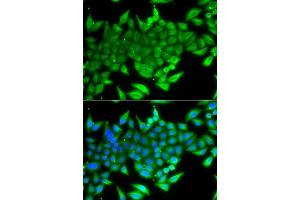 Immunofluorescence analysis of A549 cells using TTF2 antibody. (TTF2 Antikörper  (AA 1-270))