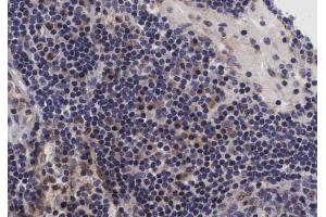 ABIN6267432 at 1/200 staining human lymph nodes tissue sections by IHC-P. (NFKB1 Antikörper  (pSer907))