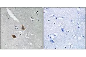 Immunohistochemistry (IHC) image for anti-Mitochondrial Ribosomal Protein L21 (MRPL21) (AA 131-180) antibody (ABIN2890052) (MRPL21 Antikörper  (AA 131-180))
