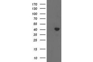 HEK293T cells were transfected with the pCMV6-ENTRY control (Left lane) or pCMV6-ENTRY ACAT2 (Right lane) cDNA for 48 hrs and lysed. (ACAT2 Antikörper)