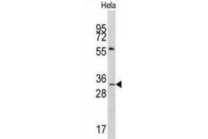 Western Blotting (WB) image for anti-Melanoma Antigen Family A, 1 (Directs Expression of Antigen MZ2-E) (MAGEA1) antibody (ABIN3002531) (MAGEA1 Antikörper)