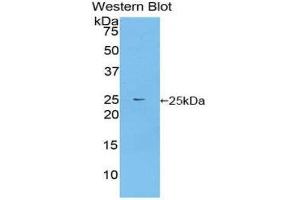 Western Blotting (WB) image for anti-Fibroblast Growth Factor Receptor Substrate 2 (FRS2) (AA 268-453) antibody (ABIN1858918) (FRS2 Antikörper  (AA 268-453))