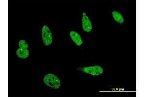 Immunofluorescence (IF) image for anti-Homeodomain Interacting Protein Kinase 1 (HIPK1) (AA 330-430) antibody (ABIN531311)