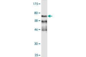 FGFR1OP anticorps  (AA 1-379)