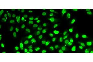 Immunofluorescence analysis of HeLa cells using PBEF / NAMPT Polyclonal Antibody (NAMPT Antikörper)