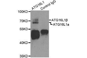 Western Blotting (WB) image for anti-ATG16 Autophagy Related 16-Like 1 (ATG16L1) antibody (ABIN1871137) (ATG16L1 Antikörper)