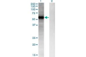 Western Blot analysis of FZD4 expression in transfected 293T cell line by FZD4 monoclonal antibody (M02A), clone 3G7.